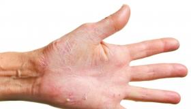 Ликбез для золушек: восстанавливаем очень сухую кожу рук Восстановить кожу рук после моющих средств